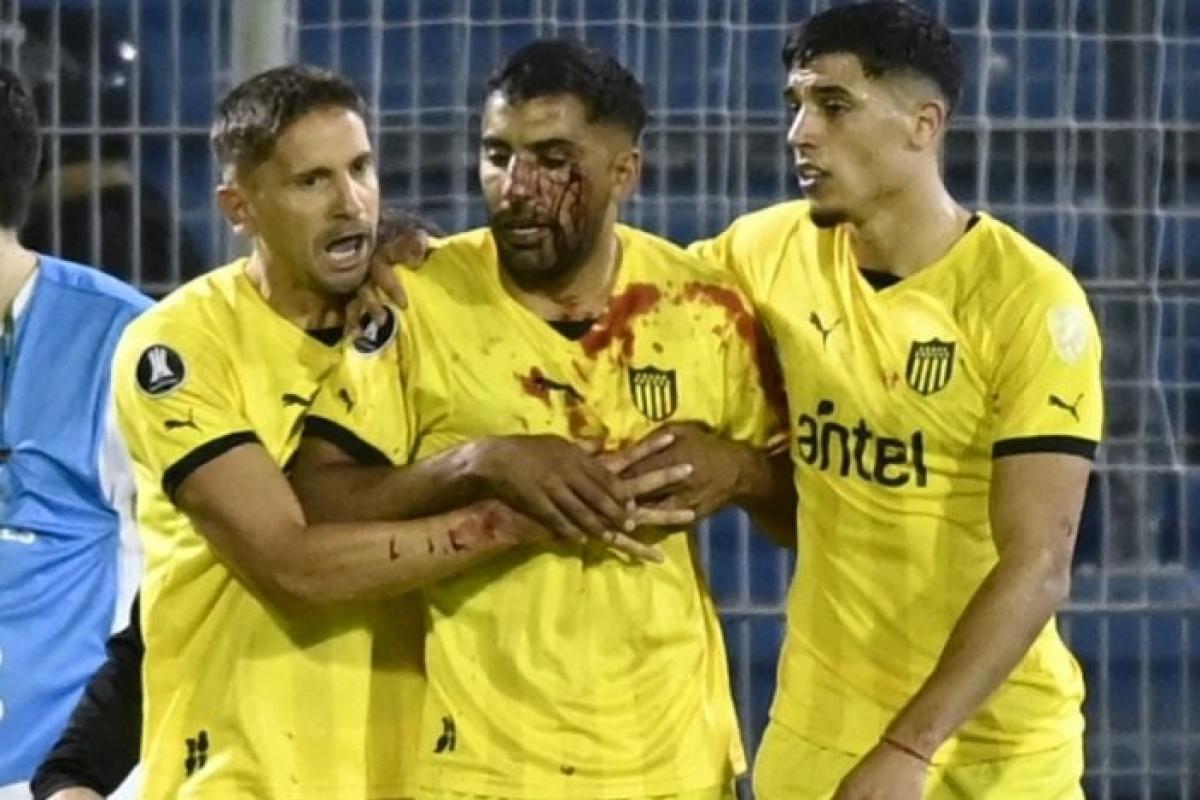 VIDEOS | Las imágenes de la violenta noche en Rosario entre Central y Peñarol