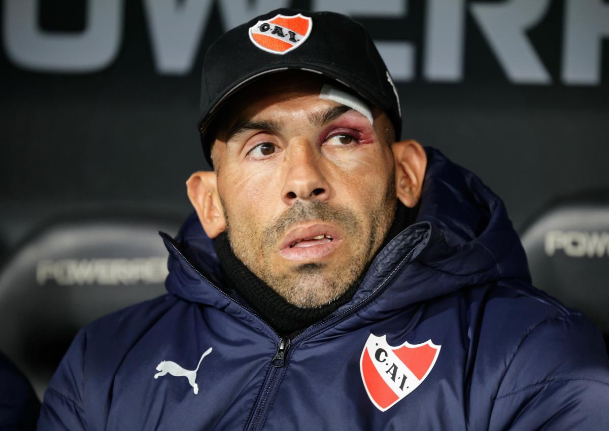 Tevez se tomó con humor el accidente que sufrió